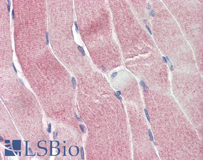 Anti-SIRT4 antibody IHC of human skeletal muscle. Immunohistochemistry of formalin-fixed, paraffin-embedded tissue after heat-induced antigen retrieval. Antibody LS-B2493 concentration 5 ug/ml.