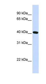 SIRT4 antibody LS-C109170 Western blot of Fetal Heart lysate.