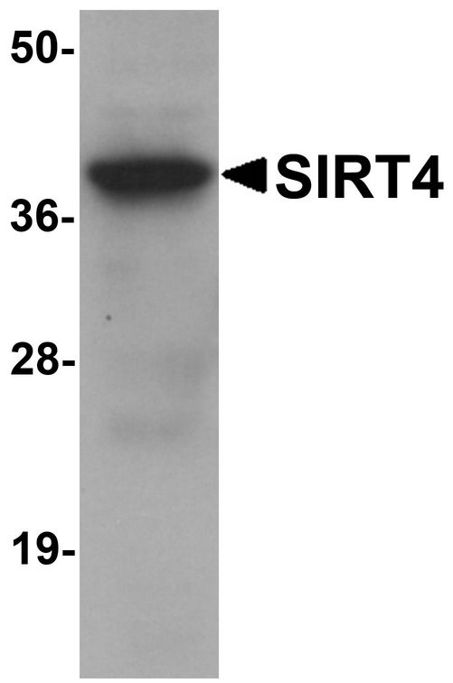 Western blot analysis of SIRT4 in human liver tissue lysate with SIRT4 antibody at 1 ug/ml.