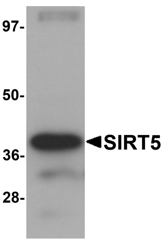 Western blot analysis of SIRT5 in human liver tissue lysate with SIRT5 antibody at 1 ug/ml.