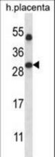 SIRT5 Antibody western blot of human placenta tissue lysates (35 ug/lane). The SIRT5 antibody detected the SIRT5 protein (arrow).