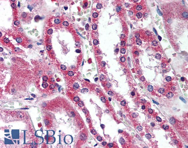 Anti-SIRT5 antibody IHC of human kidney. Immunohistochemistry of formalin-fixed, paraffin-embedded tissue after heat-induced antigen retrieval. Antibody LS-B2060 concentration 5 ug/ml.