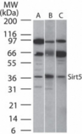 Western blot of SIRT5 in A) human, B) mouse and C) rat intestine cell lysate using antibody at 2 ug/ml.