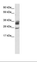 Fetal Heart Lysate
