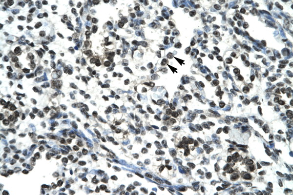 SIRT5 antibody LS-C30722 IHC of formalin-fixed, paraffin-embedded human Lung. Positive label: Alveolar cells indicated with arrows. Antibody concentration 4-8 ug/ml. Magnification 400X.