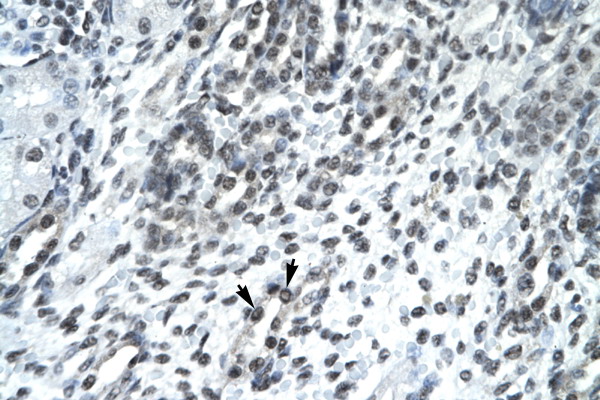 SIRT5 antibody LS-C30722 IHC of formalin-fixed, paraffin-embedded human Kidney. Positive label: Epithelial cells of renal tubule indicated with arrows. Antibody concentration 4-8 ug/ml. Magnification 400X.