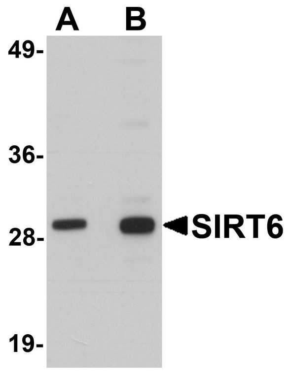 Western blot analysis of SIRT6 in HeLa cell lysate with SIRT6 antibody at (A) 0.5 and (B) 1 ug/ml.