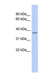 SIRT6 antibody LS-B5588 Western blot of Fetal Spleen lysate.