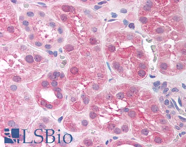 Anti-SIRT7 antibody IHC of human kidney. Immunohistochemistry of formalin-fixed, paraffin-embedded tissue after heat-induced antigen retrieval. Antibody LS-B1566 concentration 5 ug/ml.