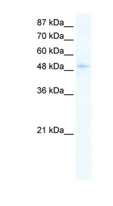 SIRT7 antibody LS-B1566 Western blot of Jurkat lysate.