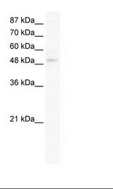 Jurkat Cell Lysate