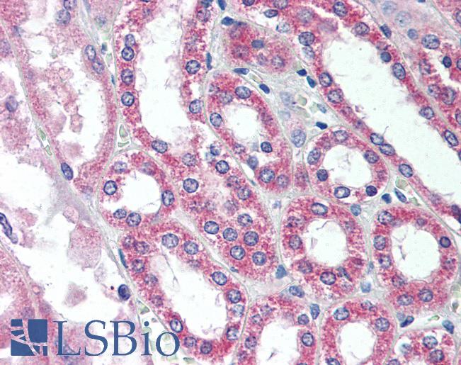 Anti-SIRT7 antibody IHC of human kidney. Immunohistochemistry of formalin-fixed, paraffin-embedded tissue after heat-induced antigen retrieval. Antibody LS-B2061 concentration 5 ug/ml.