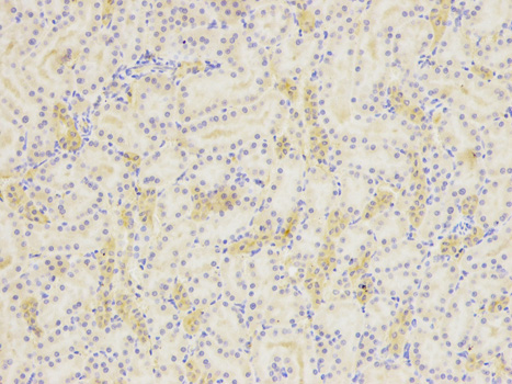 Immunohistochemistry of paraffin-embedded rat kidney using SIRT7 antibody at dilution of 1:100 (200x lens).