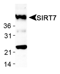 Detection of SIRT7 in human liver lysates.