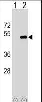 Western blot of FNTA (arrow) using rabbit polyclonal FNTA Antibody. 293 cell lysates (2 ug/lane) either nontransfected (Lane 1) or transiently transfected (Lane 2) with the FNTA gene.