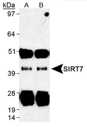 SIRT7 Immunoprecipitated from human liver lysates with SIRT7 Antibody LS-C141854. A). SIRT7 Antibody LS-C141851 B). SIRT7 Antibody LS-C141850