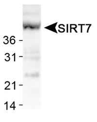 Detection of SIRT7 in human liver lysates.