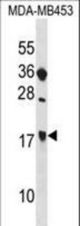 SIT1 Antibody western blot of MDA-MB453 cell line lysates (35 ug/lane). The SIT1 antibody detected the SIT1 protein (arrow).