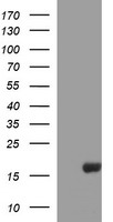 HEK293T cells were transfected with the pCMV6-ENTRY control (Left lane) or pCMV6-ENTRY SIVA1 (Right lane) cDNA for 48 hrs and lysed. Equivalent amounts of cell lysates (5 ug per lane) were separated by SDS-PAGE and immunoblotted with anti-SIVA1.