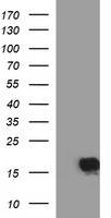 HEK293T cells were transfected with the pCMV6-ENTRY control (Left lane) or pCMV6-ENTRY SIVA1 (Right lane) cDNA for 48 hrs and lysed. Equivalent amounts of cell lysates (5 ug per lane) were separated by SDS-PAGE and immunoblotted with anti-SIVA1.
