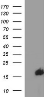HEK293T cells were transfected with the pCMV6-ENTRY control (Left lane) or pCMV6-ENTRY SIVA1 (Right lane) cDNA for 48 hrs and lysed. Equivalent amounts of cell lysates (5 ug per lane) were separated by SDS-PAGE and immunoblotted with anti-SIVA1.