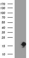 HEK293T cells were transfected with the pCMV6-ENTRY control (Left lane) or pCMV6-ENTRY SIVA1 (Right lane) cDNA for 48 hrs and lysed. Equivalent amounts of cell lysates (5 ug per lane) were separated by SDS-PAGE and immunoblotted with anti-SIVA1.