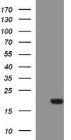 HEK293T cells were transfected with the pCMV6-ENTRY control (Left lane) or pCMV6-ENTRY SIVA1 (Right lane) cDNA for 48 hrs and lysed. Equivalent amounts of cell lysates (5 ug per lane) were separated by SDS-PAGE and immunoblotted with anti-SIVA1.