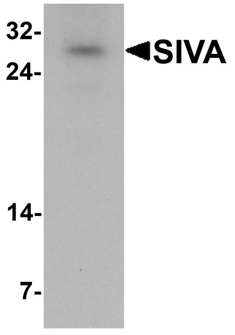 Western blot analysis of SIVA in mouse liver tissue lysate with SIVA antibody at 1 ug/ml.