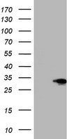 HEK293T cells were transfected with the pCMV6-ENTRY control (Left lane) or pCMV6-ENTRY SIX1 (Right lane) cDNA for 48 hrs and lysed. Equivalent amounts of cell lysates (5 ug per lane) were separated by SDS-PAGE and immunoblotted with anti-SIX1.