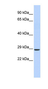 SIX2 antibody LS-C101742 Western blot of Fetal Muscle lysate.