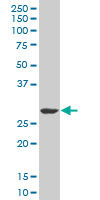 SIX3 monoclonal antibody (M01), clone 3D12. Western Blot analysis of SIX3 expression in MES-SA/Dx5.