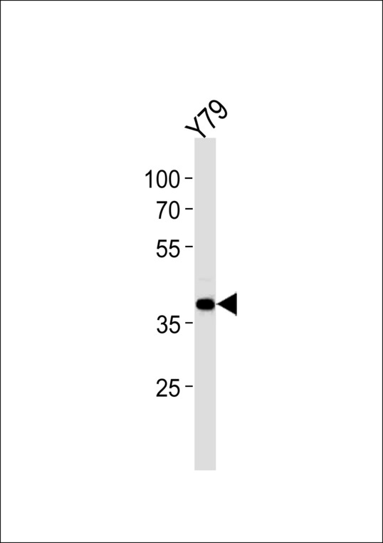 SIX3 Antibody western blot of Y79 cell line lysates (35 ug/lane). The SIX3 antibody detected the SIX3 protein (arrow).