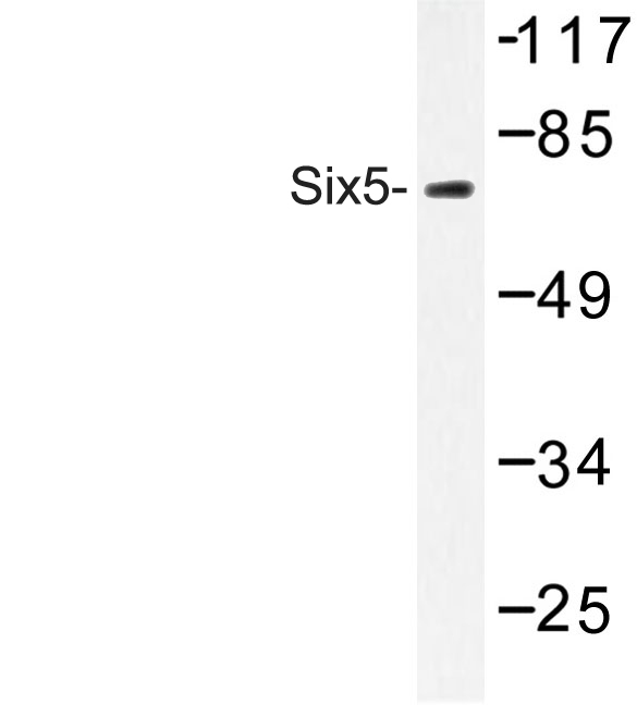 Western blot of Six5 (L237) pAb in extracts from K562 cells.
