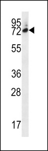 SIX5 Antibody western blot of MDA-MB231 cell line lysates (35 ug/lane). The SIX5 antibody detected the SIX5 protein (arrow).