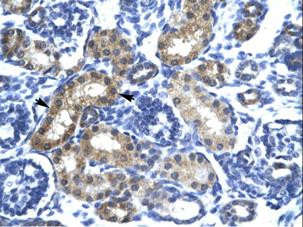 SIX6 antibody LS-C29747 was used in IHC to stain formalin-fixed, paraffin-embedded human kidney.
