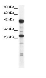 Jurkat Cell Lysate