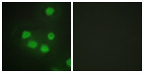 Immunofluorescence of HepG2 cells, using SIX6 Antibody. The picture on the right is treated with the synthesized peptide.