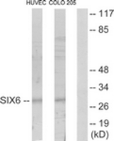 Western blot of extracts from HUVEC/COLO205 cells, using SIX6 Antibody. The lane on the right is treated with the synthesized peptide.