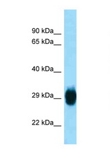 SKA1 antibody LS-C146354 Western blot of Mouse Pancreas lysate. Antibody concentration 1 ug/ml.