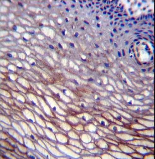 SKA2 Antibody immunohistochemistry of formalin-fixed and paraffin-embedded human cervix tissue followed by peroxidase-conjugated secondary antibody and DAB staining.