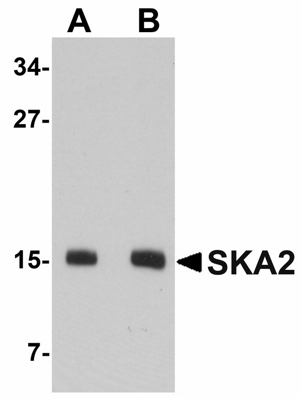 Western blot of SKA2 in 3T3 cell lysate with SKA2 antibody at (A) 0.5 and (B) 1 ug/ml.