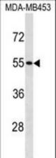 SKAP1 Antibody western blot of MDA-MB453 cell line lysates (35 ug/lane). The SKAP1 antibody detected the SKAP1 protein (arrow).