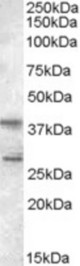 Antibody (0.5 ug/ml) staining of Jurkat lysate (35 ug protein in RIPA buffer). Primary incubation was 1 hour. Detected by chemiluminescence.