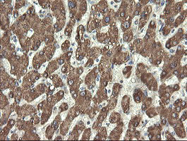 IHC of paraffin-embedded Human liver tissue using anti-PROSC mouse monoclonal antibody.