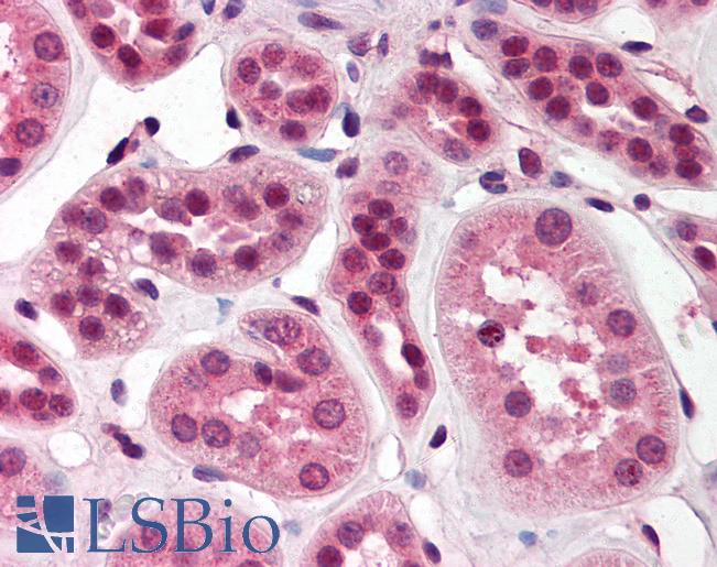 Anti-SKI antibody IHC of human kidney. Immunohistochemistry of formalin-fixed, paraffin-embedded tissue after heat-induced antigen retrieval. Antibody LS-B552 concentration 5 ug/ml.
