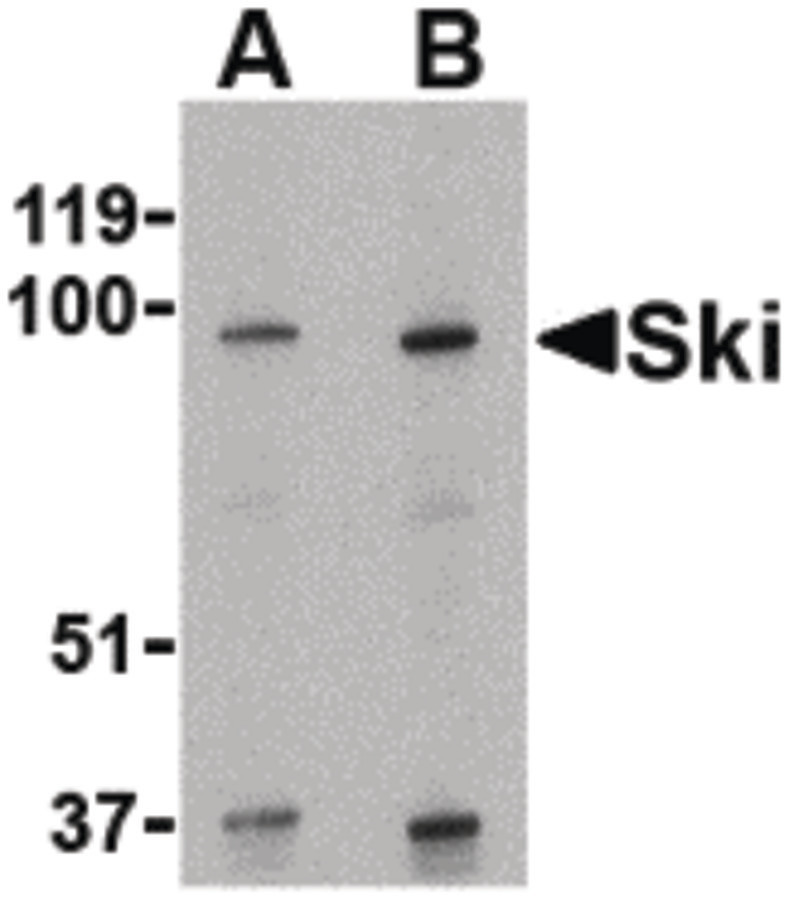 Western blot of Ski in human kidney tissue lysate with Ski antibody at (A) 1 and (B) 2 ug/ml.