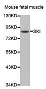 Western blot analysis of extracts of mouse fetal muscle tissue lysate , using SKI antibody.