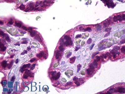 Anti-SKI antibody IHC of human placenta. Immunohistochemistry of formalin-fixed, paraffin-embedded tissue after heat-induced antigen retrieval. Antibody LS-B6729 concentration 10 ug/ml.