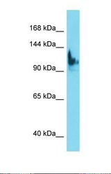 Western blot of Human HepG2. SKIDA1 antibody dilution 1.0 ug/ml.