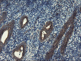 IHC of paraffin-embedded Human endometrium tissue using anti-SKIL mouse monoclonal antibody.